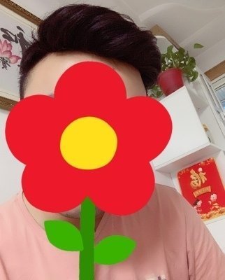 补发后效果 补发后效果