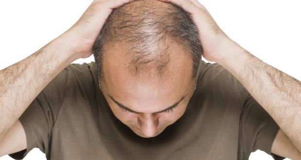 男士头顶掉发怎么解决?(正确的解决办法该是这样) 男士头顶掉发怎么解决?(正确的解决办法该是这样)