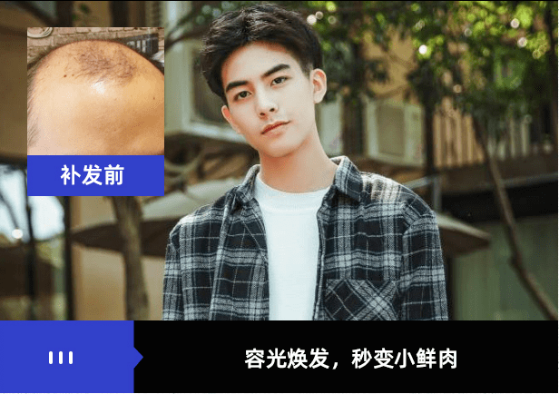 补发后容光焕发，秒变小鲜肉