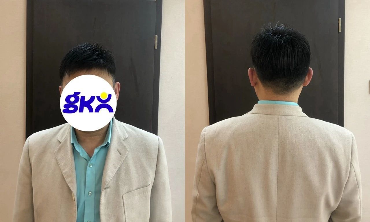 补发前后效果对比 补发前后效果对比