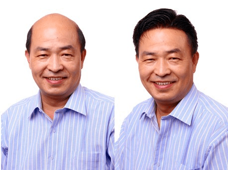 年纪偏大还能做补发吗 年纪偏大还能做补发吗