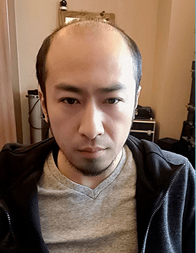 补发前效果 补发前效果