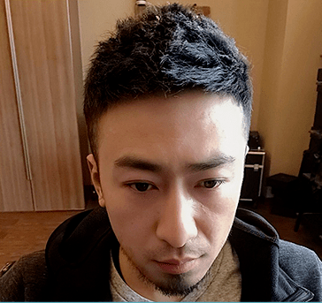 德国莎补发后效果 德国莎补发后效果