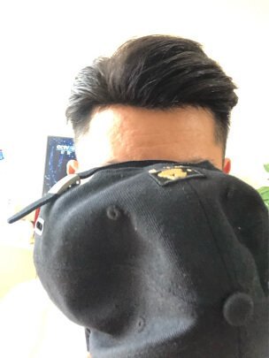 补发后效果 补发后效果