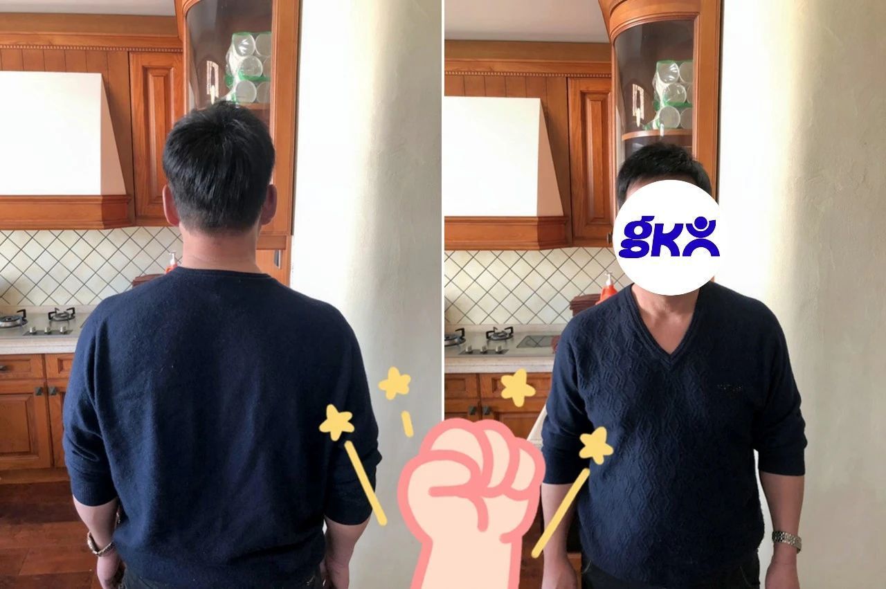 假发套补发效果