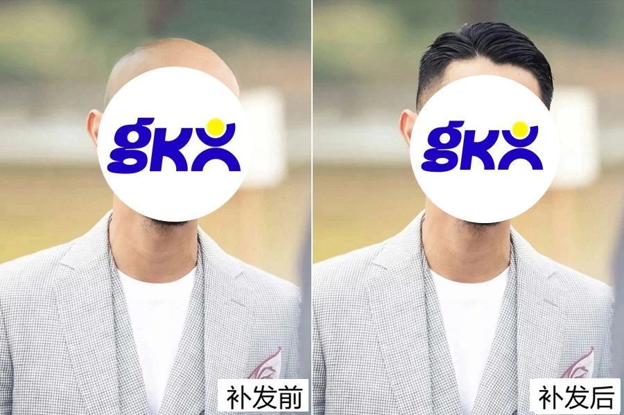 上海假发套ZUI好实体店地址在哪？