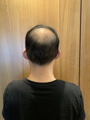 补发前背面图 补发前背面图