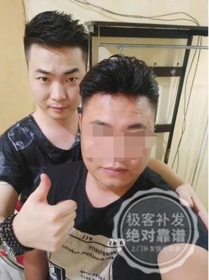 补发后效果