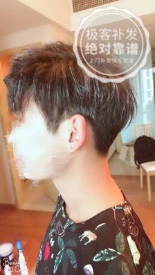 补发后侧面效果