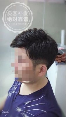 补发侧面图