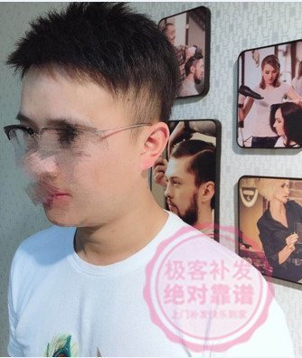 补发后效果