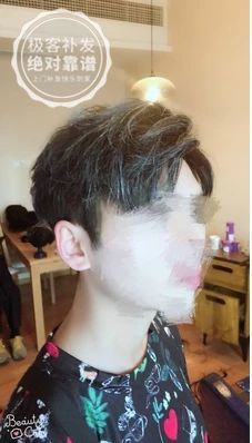 补发后正面效果