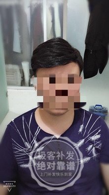 补发正面图