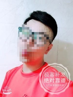 背头补发 背头补发
