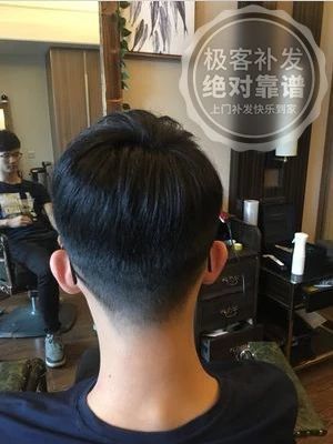 补发后背面,头发变多变浓密 补发后背面,头发变多变浓密