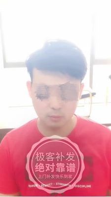补发后立即变帅气年轻 补发后立即变帅气年轻