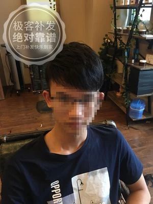 补发后正面面,头发变多变浓密,发型帅哥气 补发后正面面,头发变多变浓密,发型帅哥气