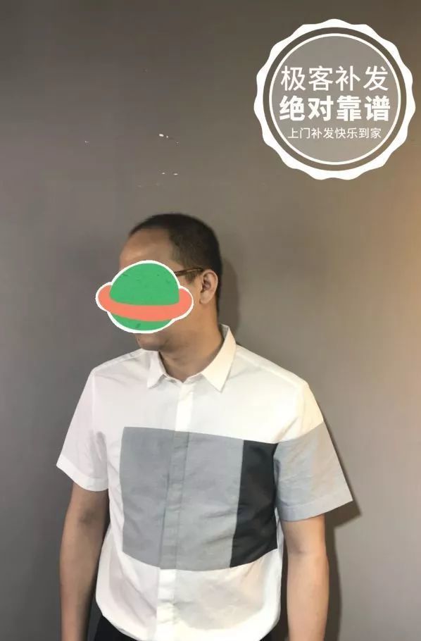 补发前老气 补发前老气