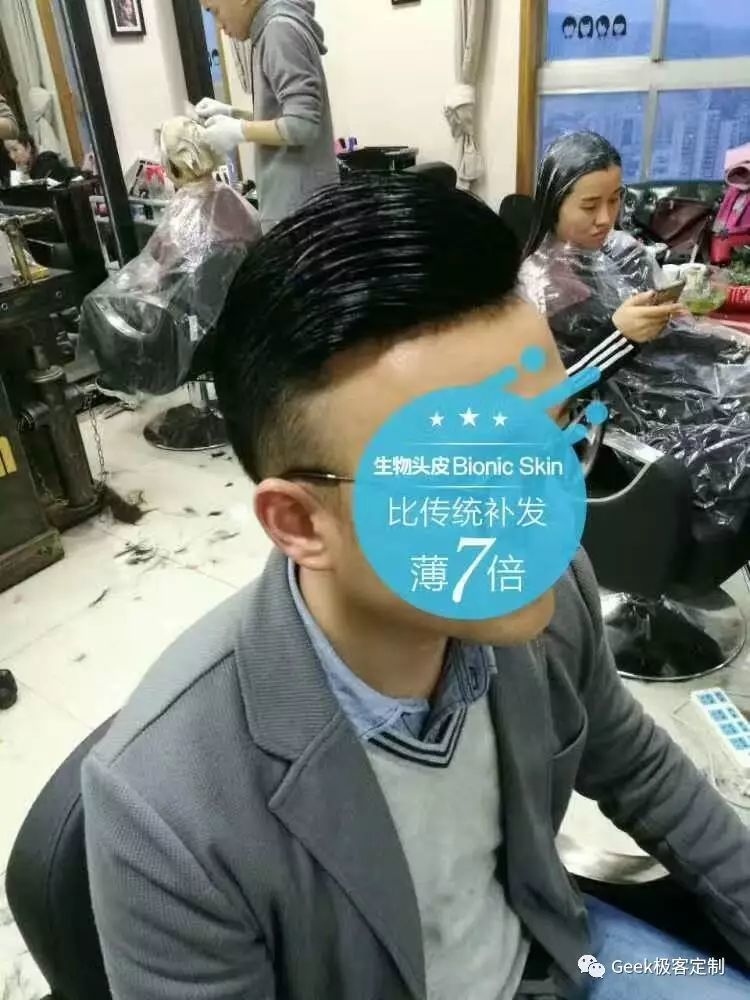 补发效果 补发效果