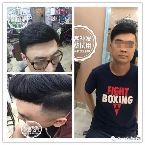 补发效果