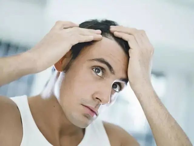 发际线后移或者M型脱发
