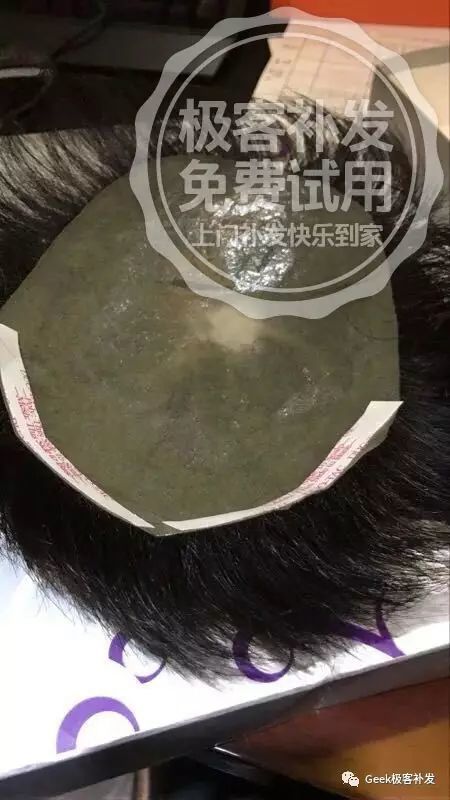 1发际线真的会面对面都看不出来吗? 1发际线真的会面对面都看不出来吗?