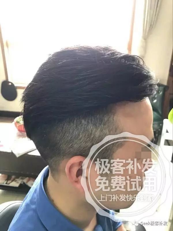极客发际线会不会被看出来呢?侧面效果 极客发际线会不会被看出来呢?侧面效果