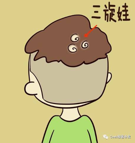 我是头旋部分脱发,补发的效果真实吗? 我是头旋部分脱发,补发的效果真实吗?
