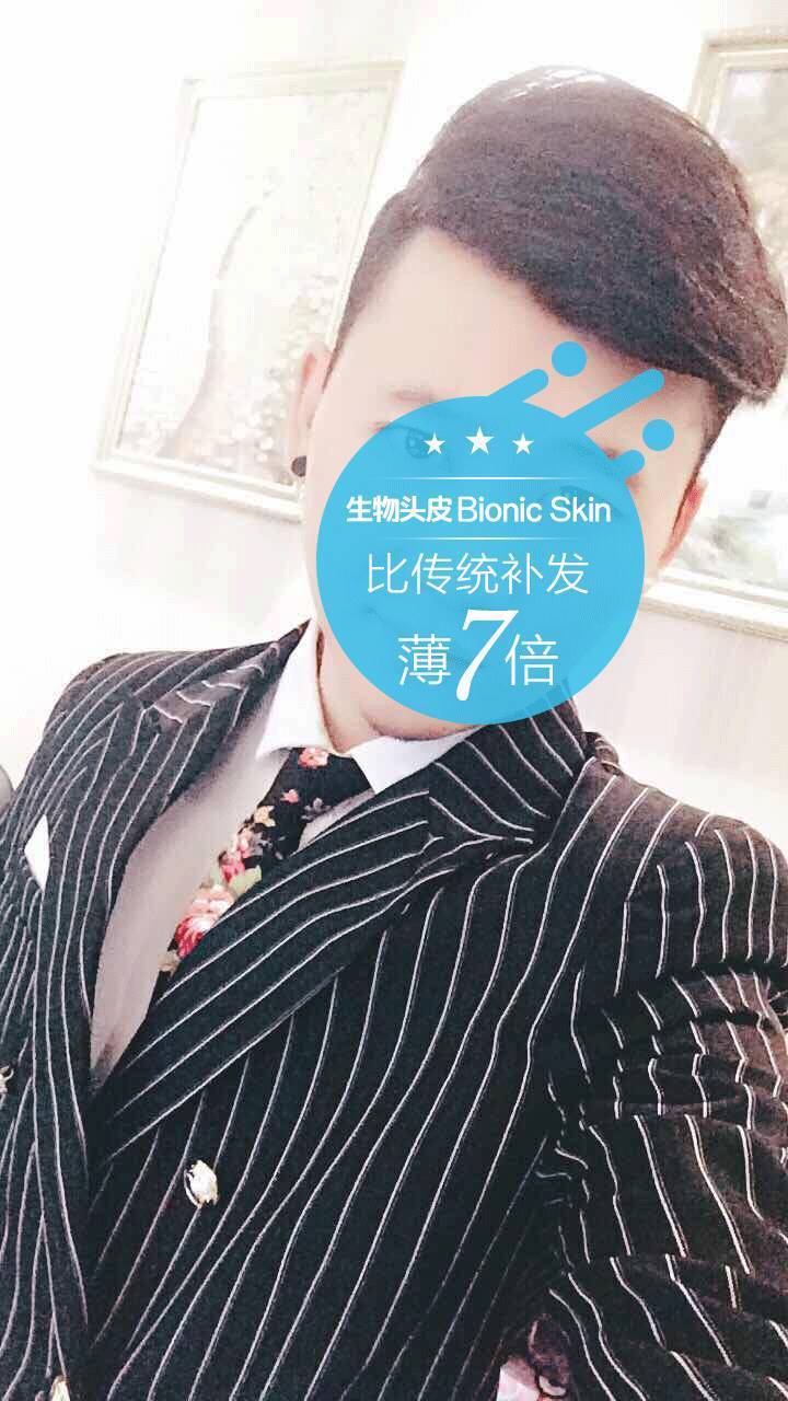 补发后效果