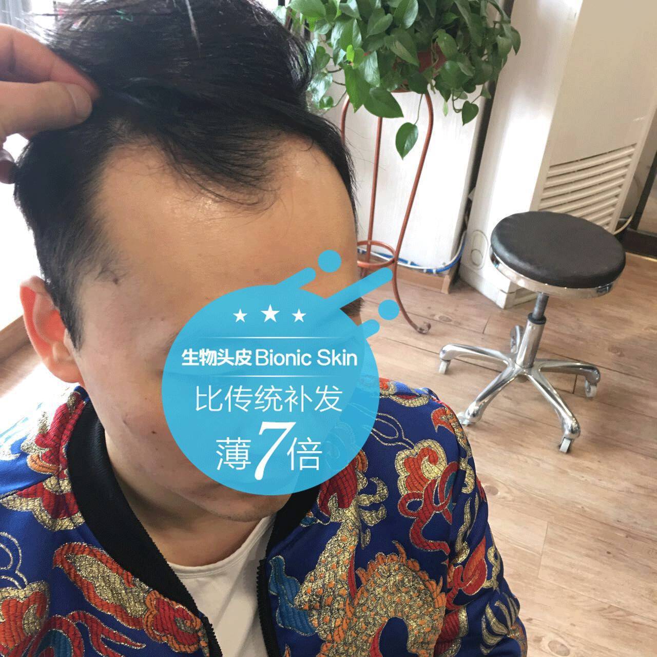 坦先生的发际线告急!