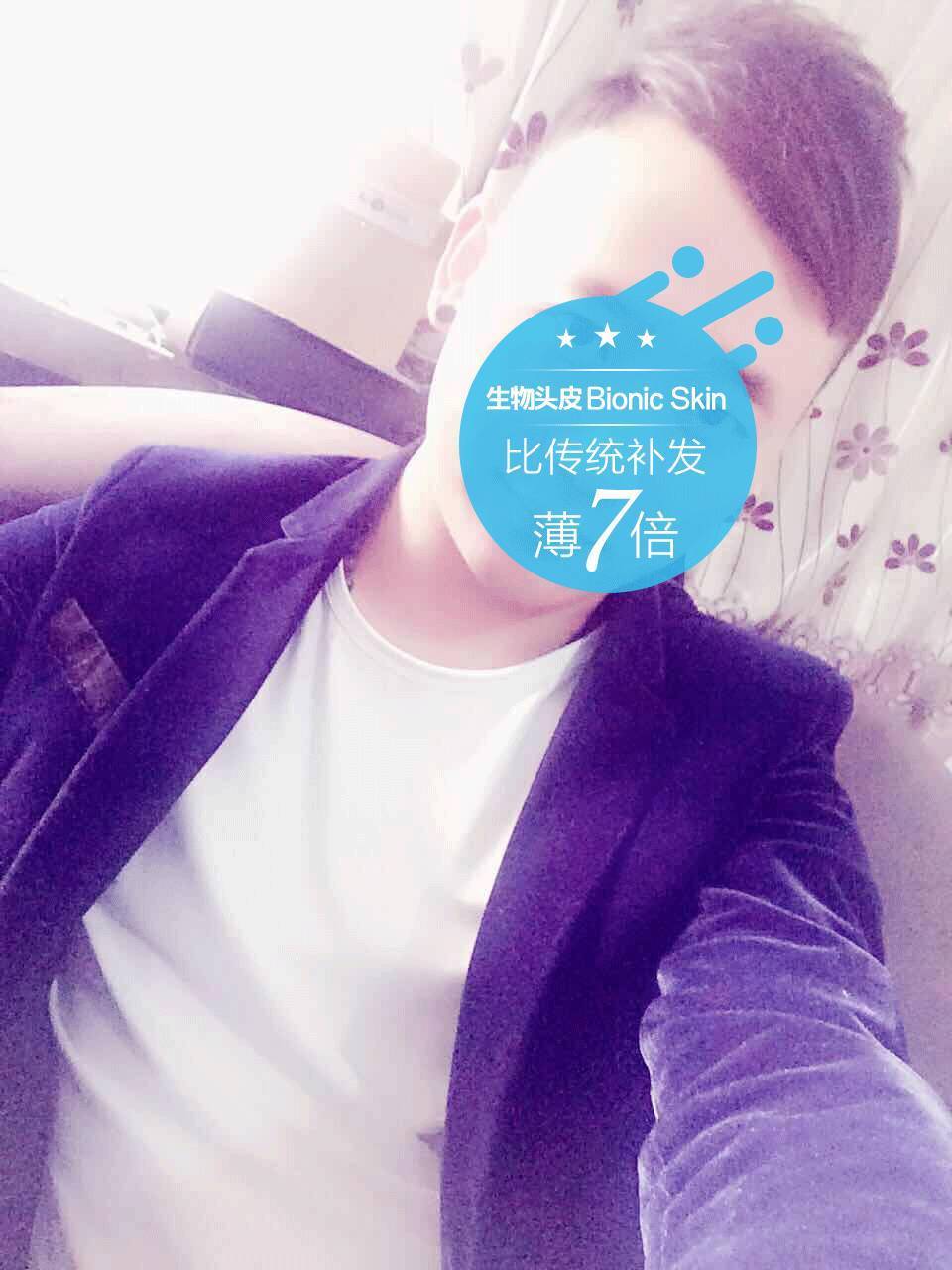 补发后年轻帅气