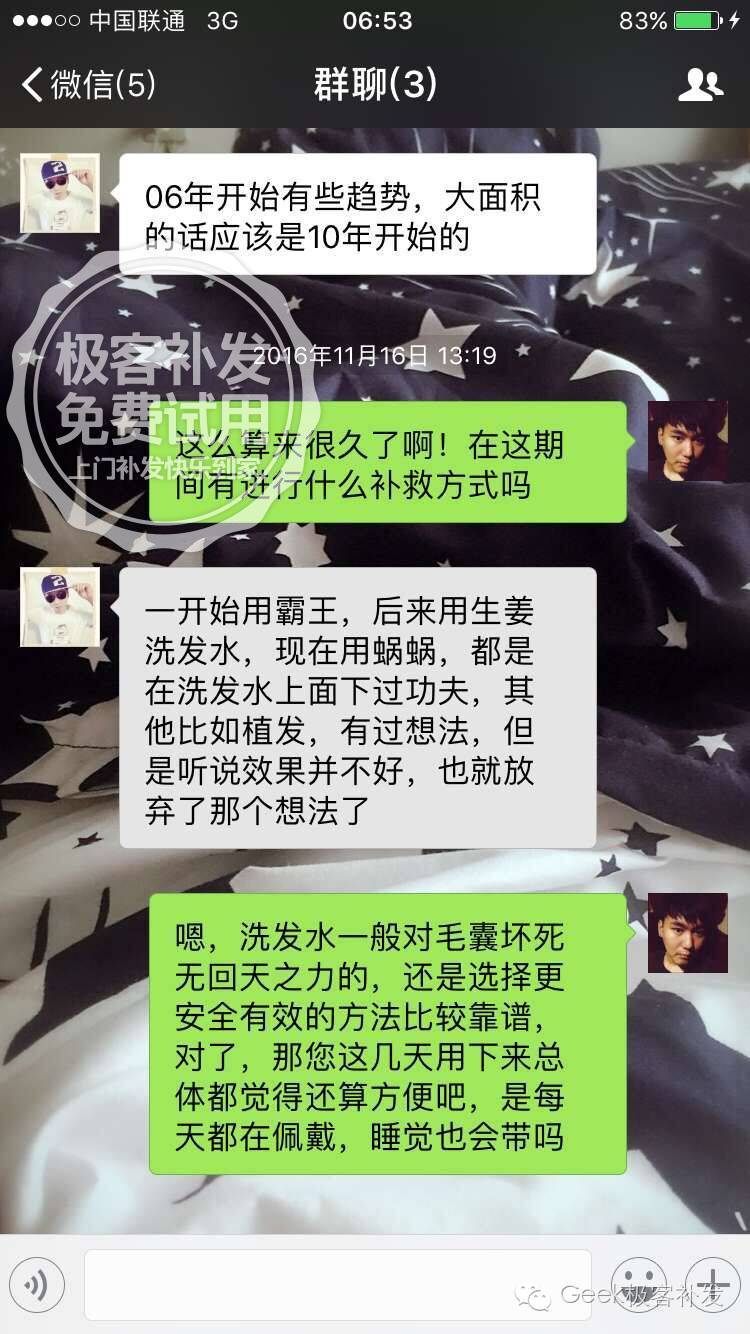 发友分享脱发故事 发友分享脱发故事