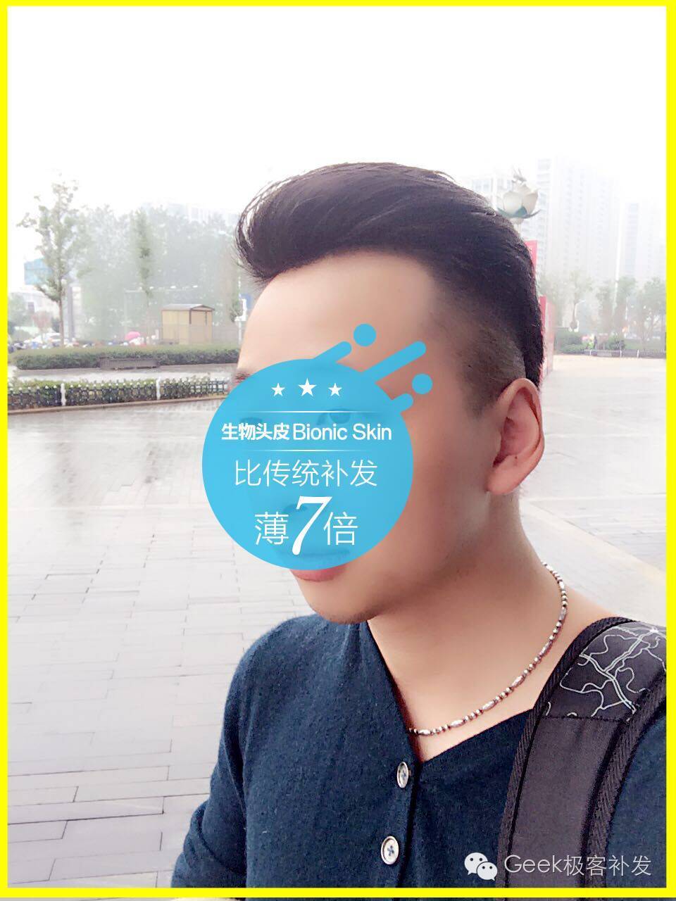 补发后毫无痕迹 补发后毫无痕迹