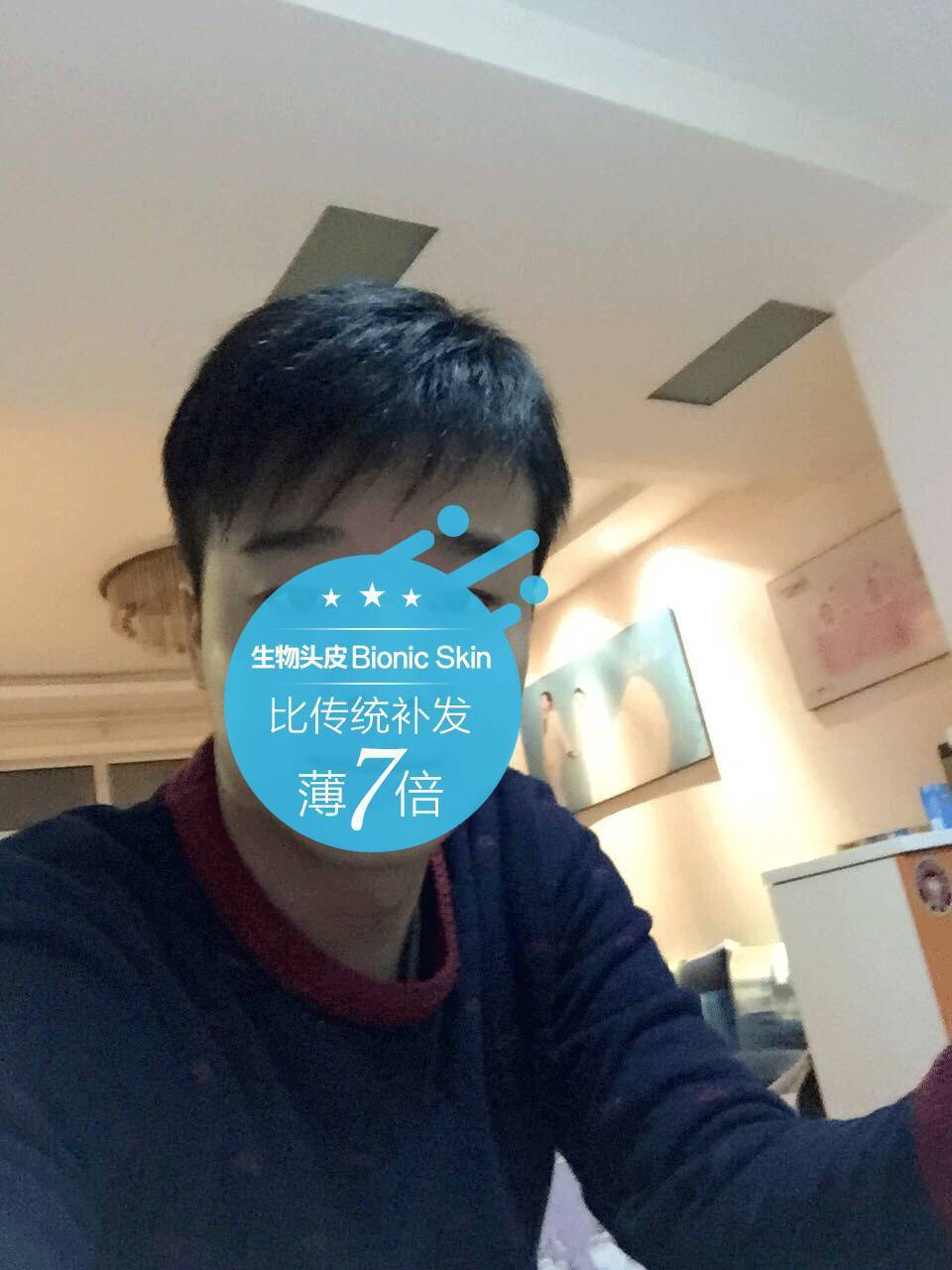 补发后效果帅气