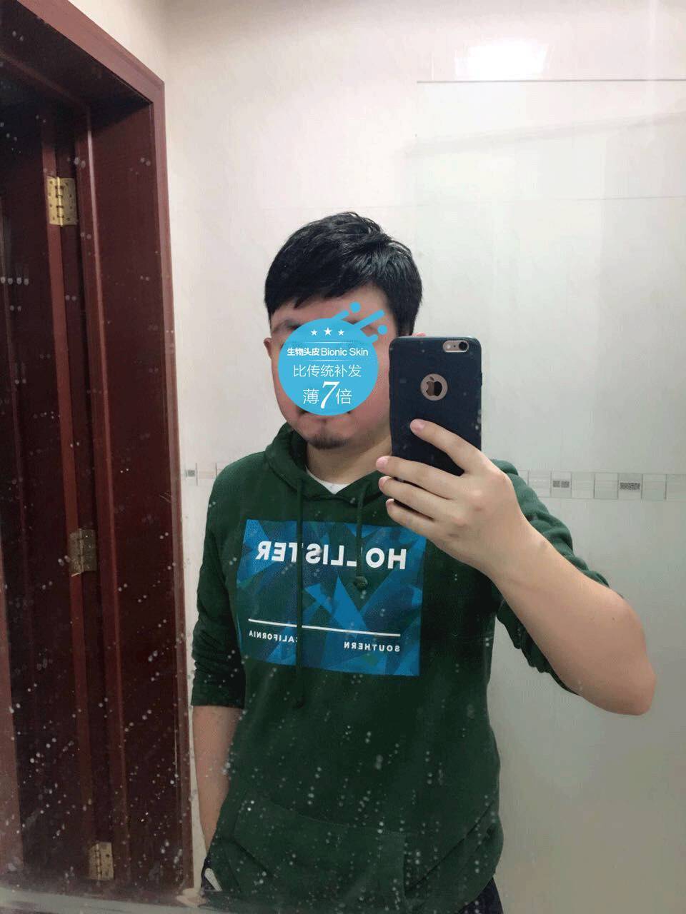 补发后年轻帅气 补发后年轻帅气