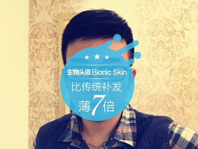补发后效果