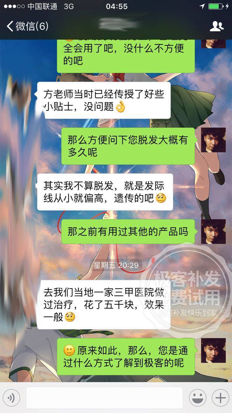 发友从小发际线偏高