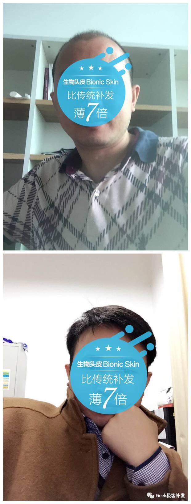 补发前后效果对比