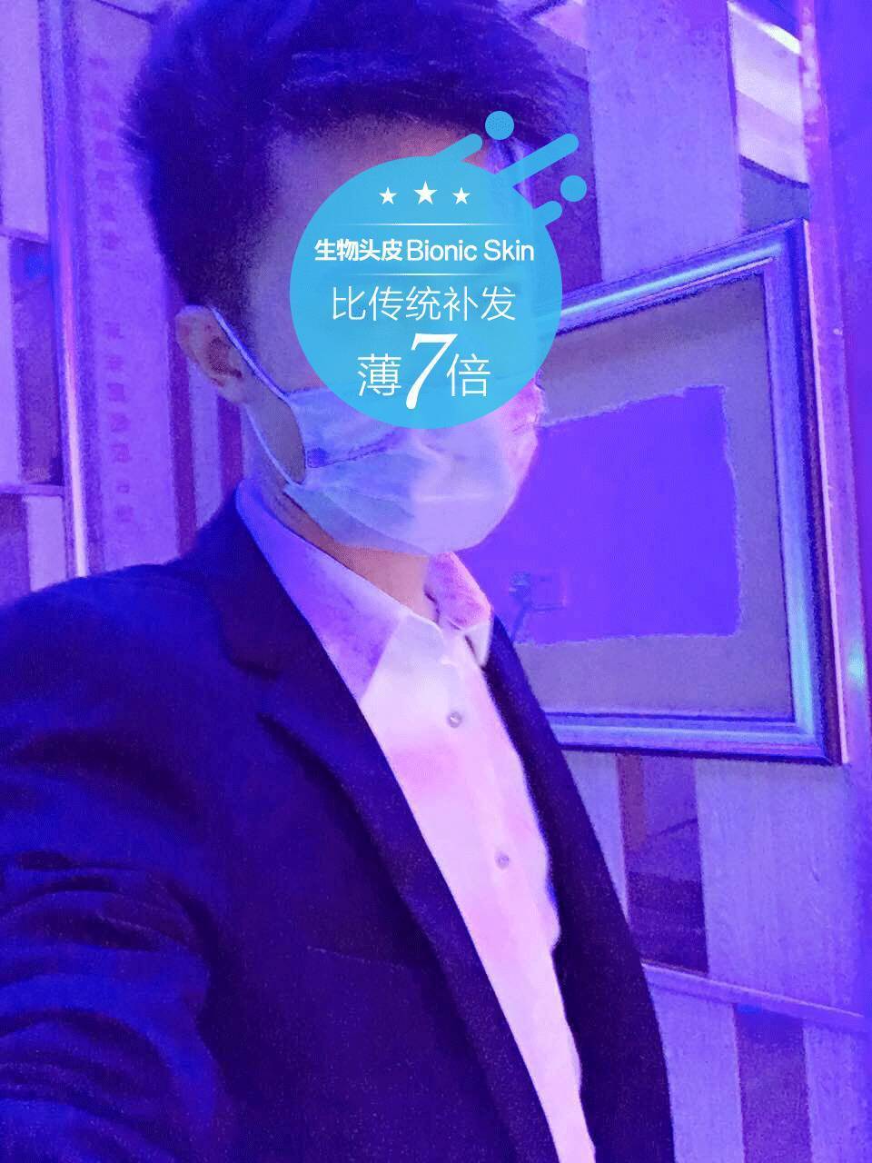 补发后片效果 补发后片效果