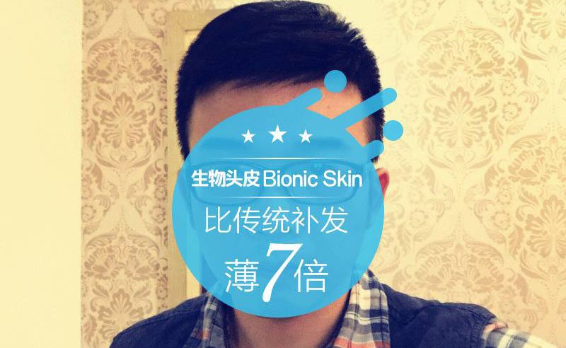 过新年，他只想要一个生物头皮假发