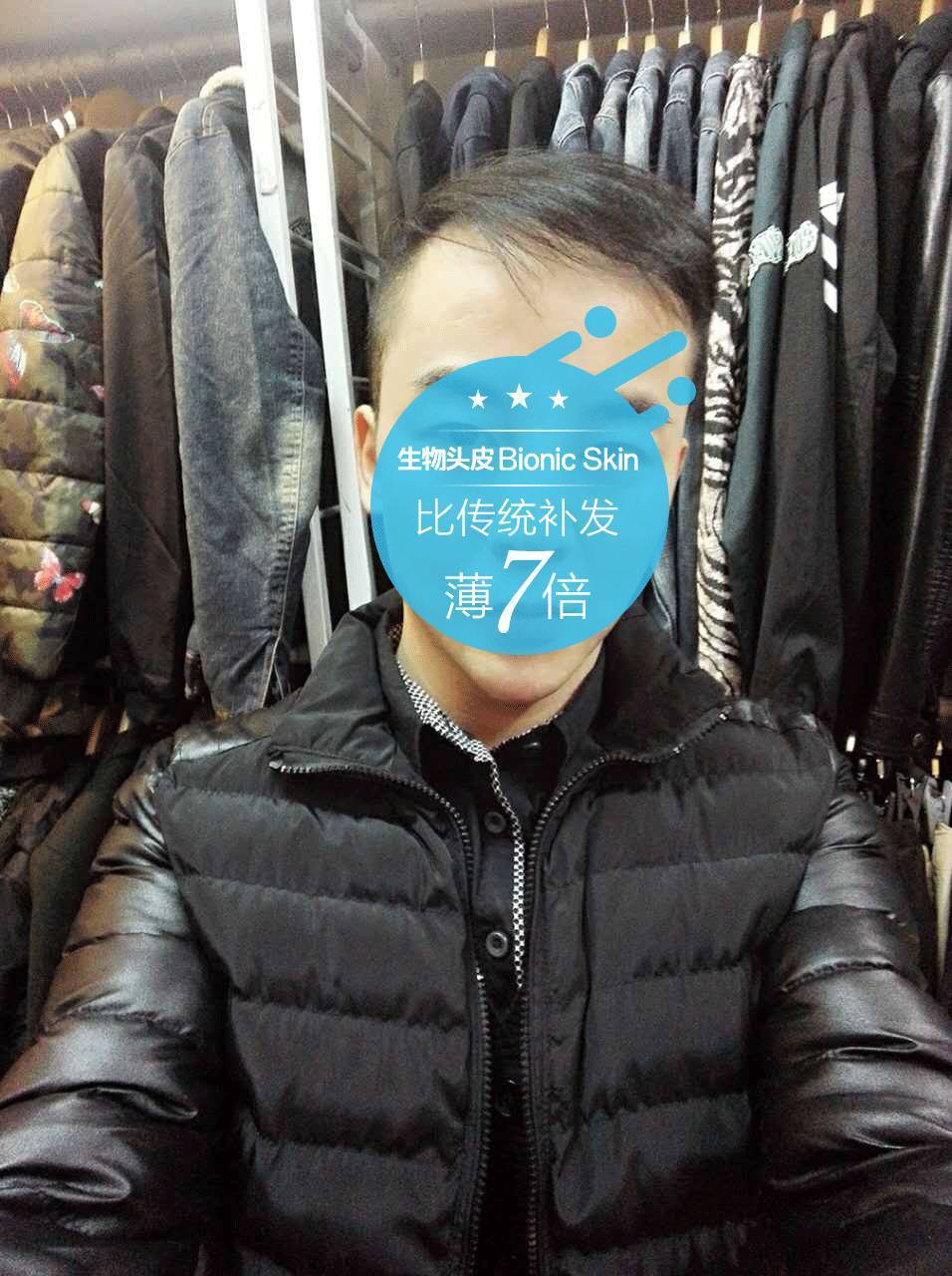 补发效果