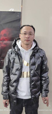 补发前发际线高 补发前发际线高