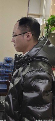 补发前侧面效果 补发前侧面效果