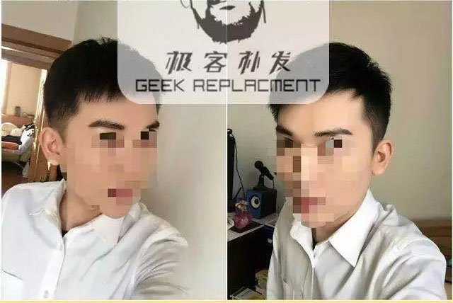 不会用生物头皮？教你玩转生物头皮