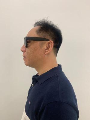 补发前侧面效果