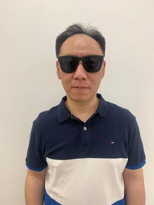 补发前发际线高