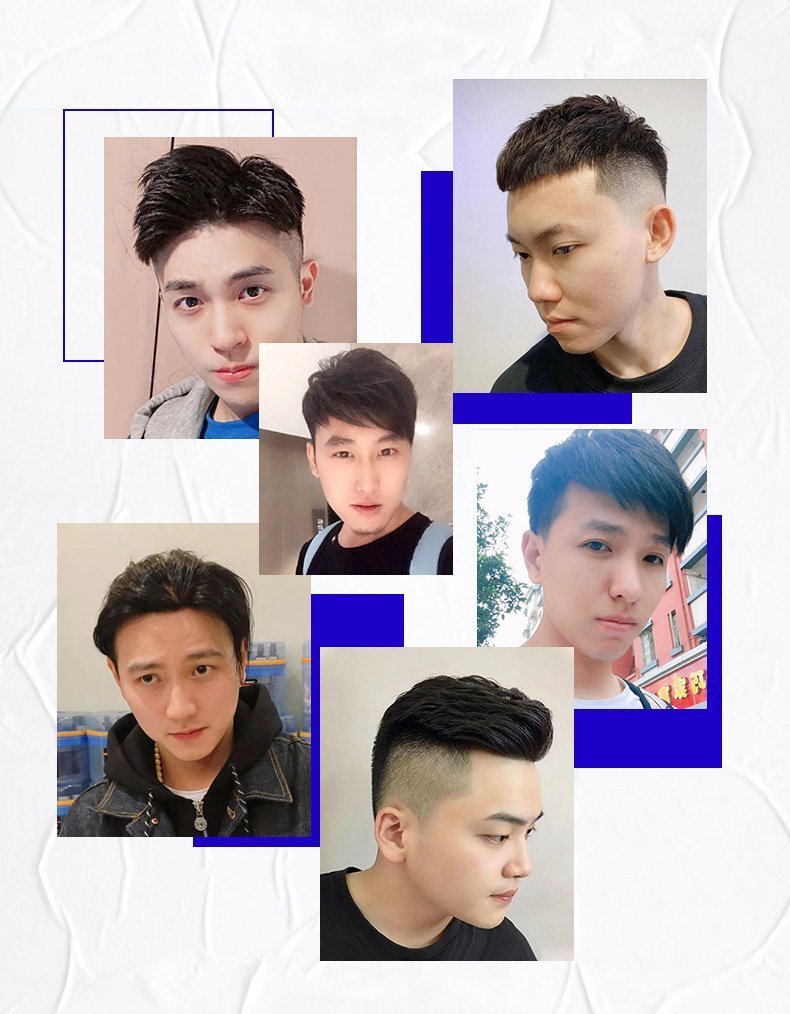 脱发严重怎么改善?https://www.jikebufa.cn/a_2 脱发严重怎么改善?https://www.jikebufa.cn/a_2