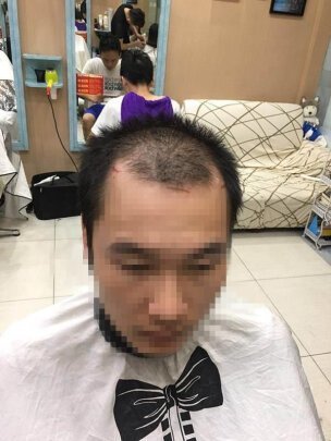 补发前效果 补发前效果