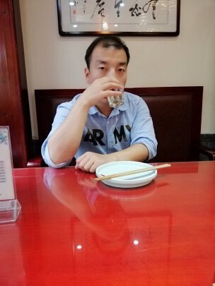 补发前呈M型脱发 补发前呈M型脱发
