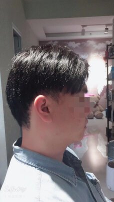补发后侧面效果